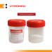 Vitromed Urine Container w/ Screw Cap, 60ml Vitromed Urine Container w/ Screw Cap, 60ml